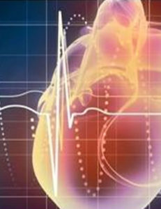 Interpretación de Electrocardiograma